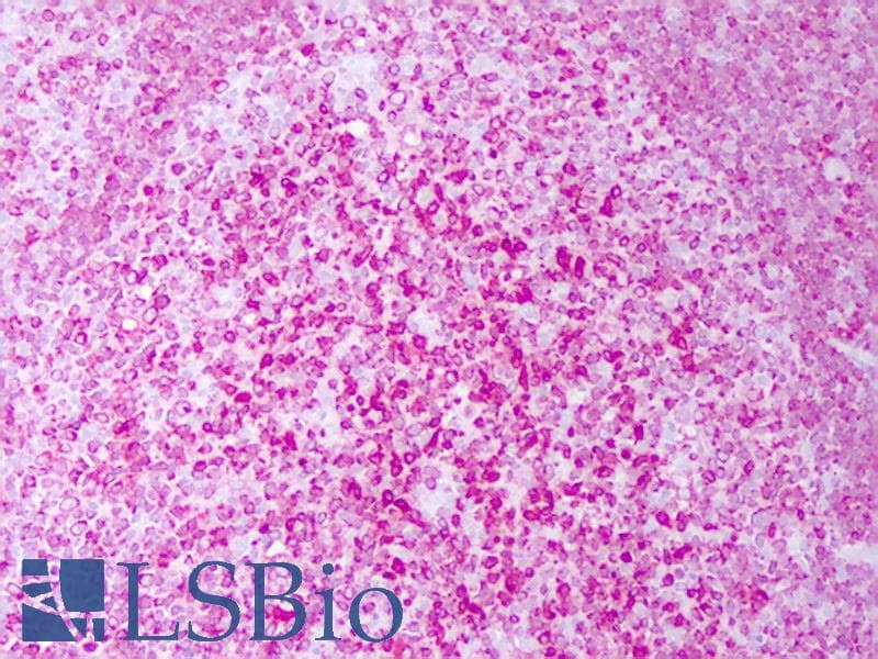 PathPlus™ CD74 / CLIP Antibody (clone PIN.1)