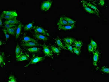 DHFR Antibody (aa2-187)