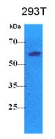 Monoclonal Mouse anti-Human PKLR Antibody (clone AT1E3, WB)