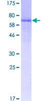 Human ART3 Protein (Recombinant GST)