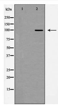 GLUR2 + GLUR3 Antibody