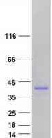 Human AMMECR1 Protein (Recombinant Myc-DDK (Flag))