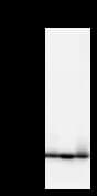 ACTB / Beta Actin Antibody (clone ACTBD11B7)
