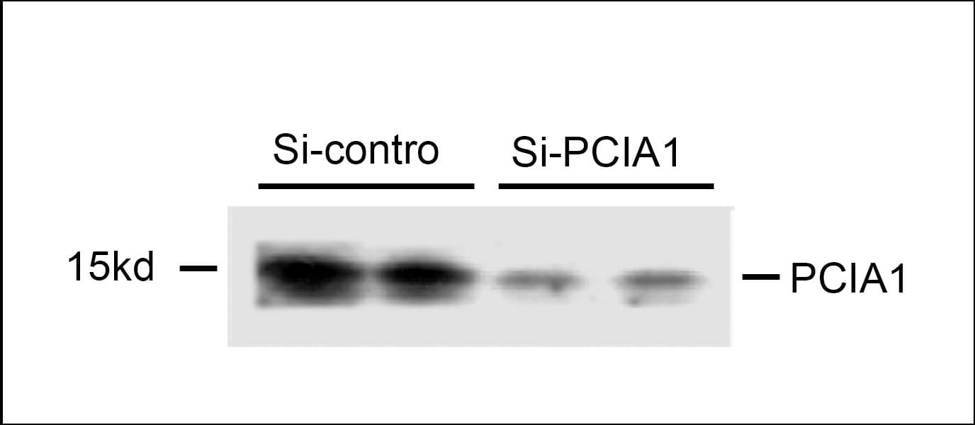 DDA1 Antibody (aa11-40)