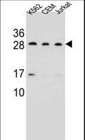 Polyclonal Rabbit anti-Human CD79A / CD79 Alpha Antibody (aa160-188, WB)