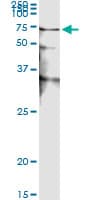 Monoclonal Mouse anti-Human STK38 Antibody (clone 2G8-1F3, IHC, IF, WB)