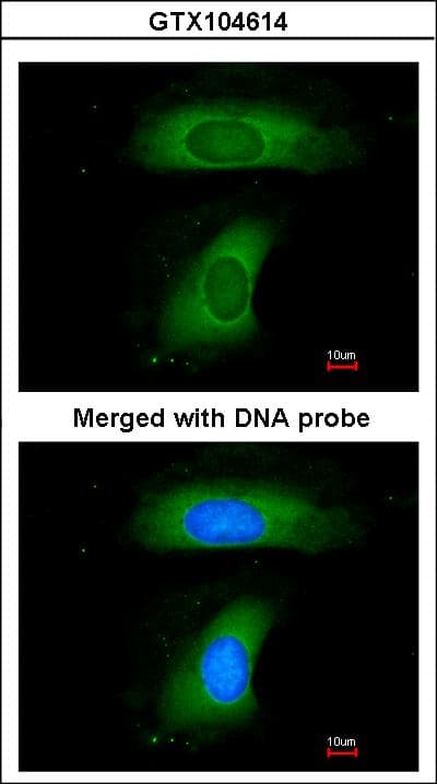 BLNK Antibody (aa394-456)