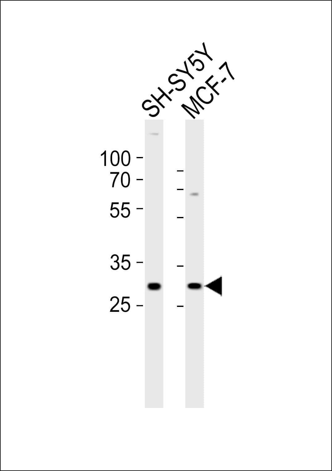 HES1 / HES-1 Antibody (aa259-293)
