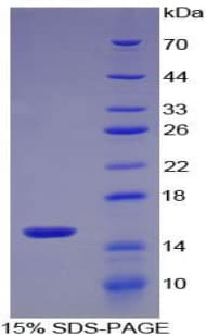 Mouse S100A9 / MRP14 Protein (Recombinant His)