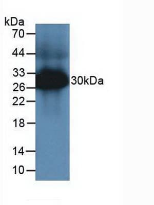 Tryptase Antibody (aa149-273)