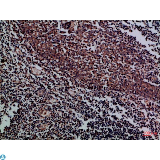 KIR2DL5A / KIR2DL5 Antibody