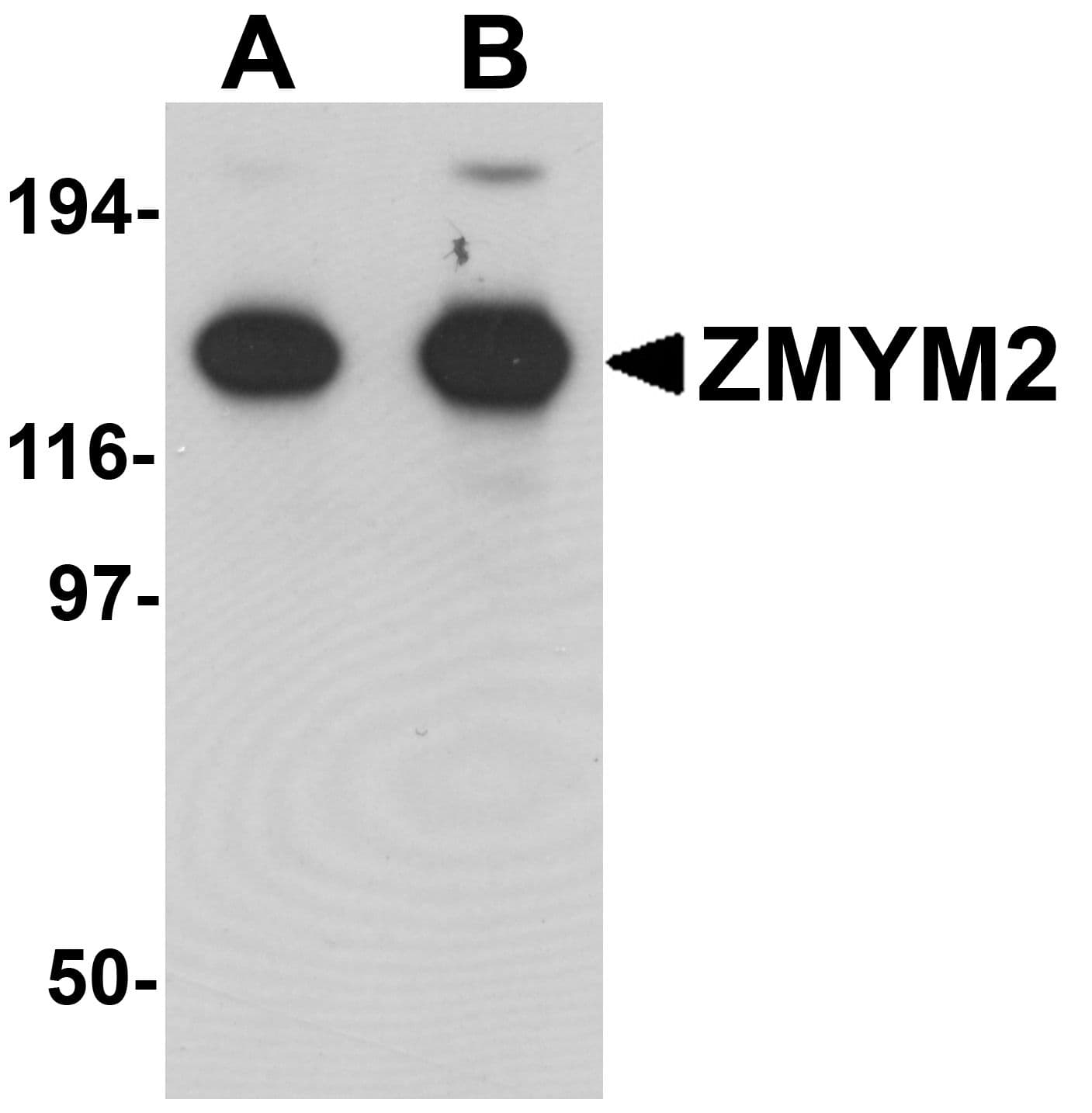 IHC-plus™ ZMYM2 / RAMP Antibody