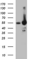 PathPlus™ TH / Tyrosine Hydroxylase Antibody (clone OTI3H3)
