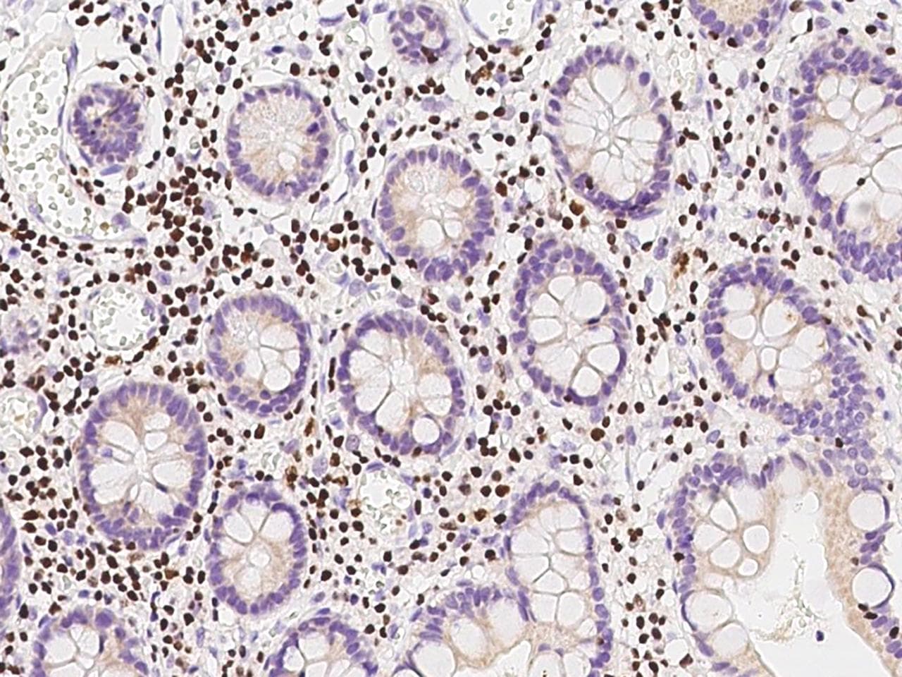 IKZF1 / IKAROS Antibody