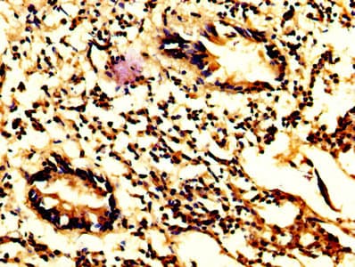 CASP7 / Caspase 7 Antibody