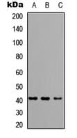 HLA-A/B/C Antibody (Internal)