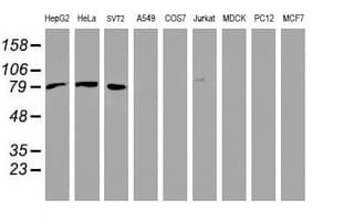 IHC-plus™ CTNNB1 / Beta Catenin Antibody (clone 1H10)