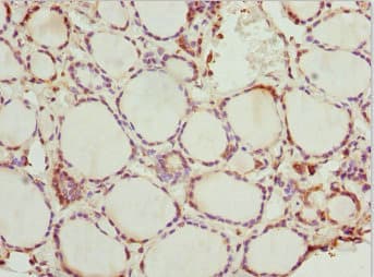 Peripherin Antibody (aa1-260)