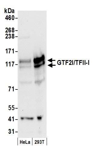 GTF2I / TFII I Antibody (aa950-C-term)