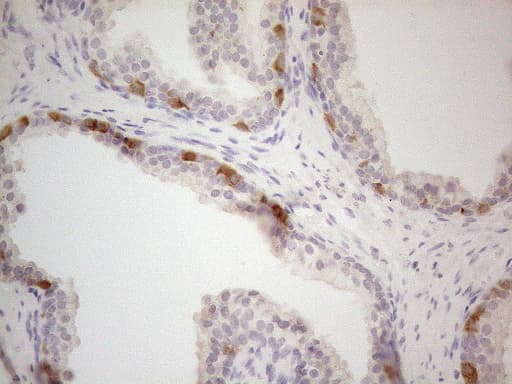 PDIA6 / ERP5 Antibody (clone OTI2H3)