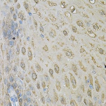 ALDH3A1 Antibody