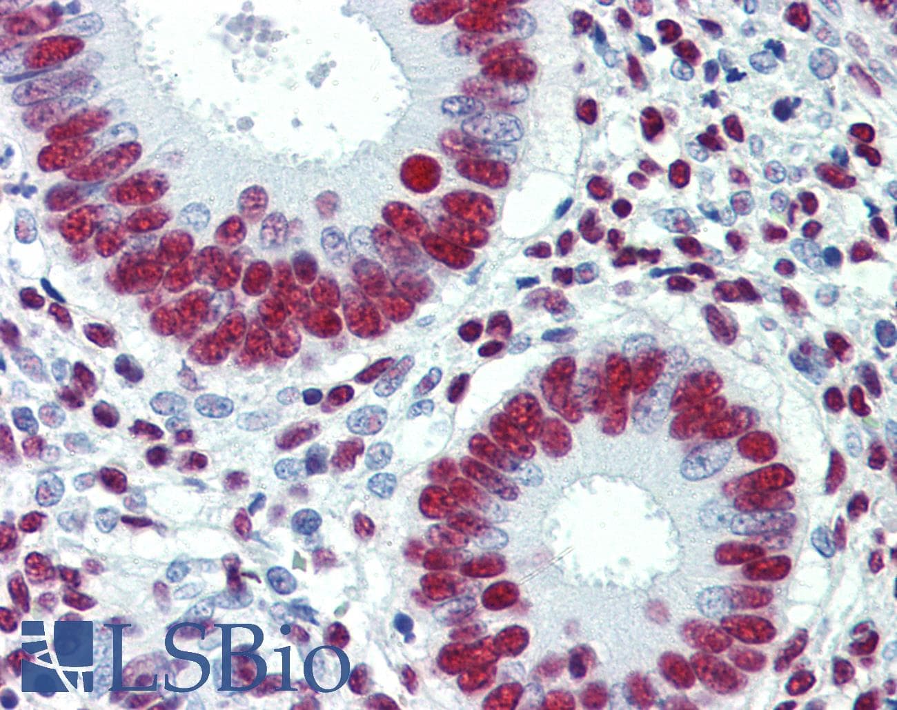 IHC-plus™ Polyclonal Rabbit anti-Human GRB2 Antibody (IHC, WB)