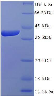 Human IZUMO4 Protein (Recombinant His-SUMO)
