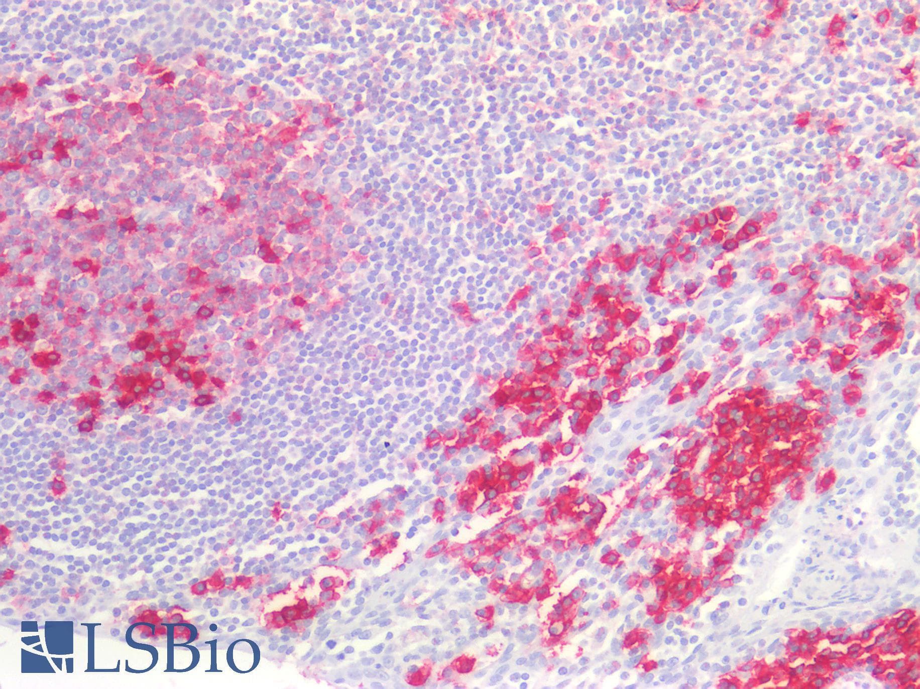 PathPlus™ CD38 Antibody (clone 6E12D4A12)