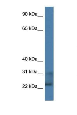 Polyclonal Rabbit anti-Human TNFSF9 / CD137L Antibody (aa160-209, IHC, WB)