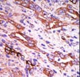 Polyclonal Rabbit anti-Human Rhodopsin Kinase / GRK1 Antibody (aa520-550, IHC, WB)