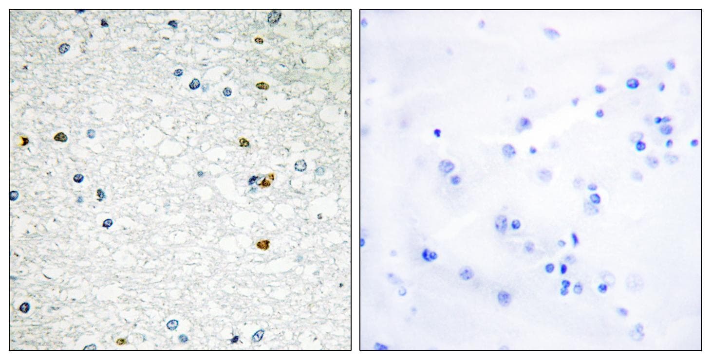 Polyclonal Rabbit anti-Human PARP3 Antibody (IHC)
