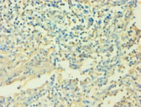 IL6 / Interleukin 6 Antibody