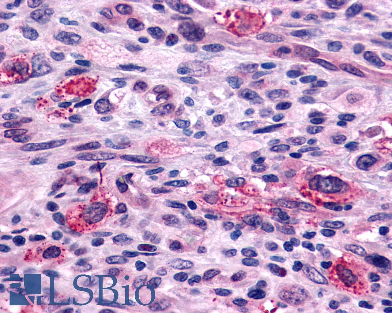 PathPlus™ Polyclonal Rabbit anti-Human F2RL1 / PAR2 Antibody (C-Terminus, IHC)