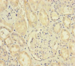 Polyclonal Rabbit anti-Human SCFD1 / SLY1 Antibody (IHC, WB)