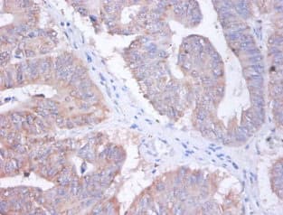 Polyclonal Rabbit anti-Human AP2S1 Antibody (IHC, WB)