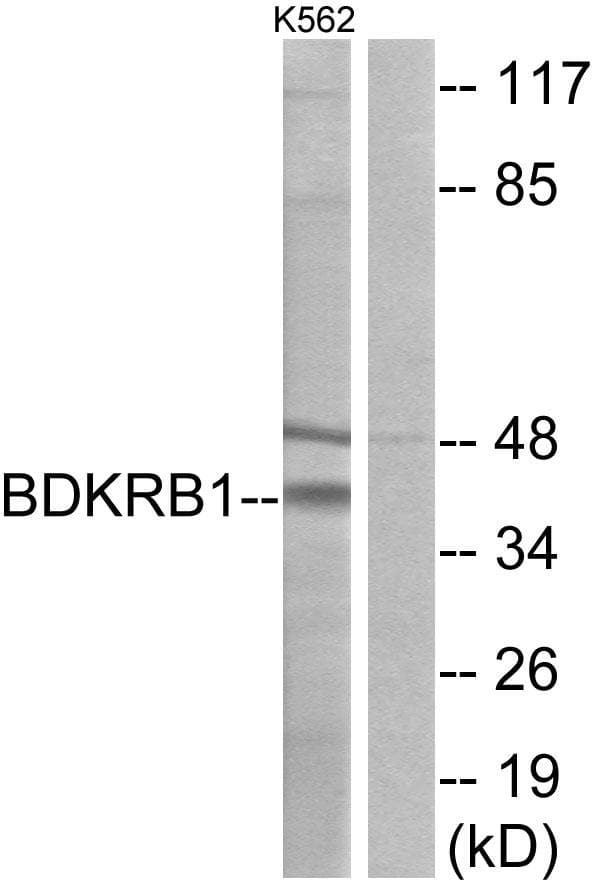 B1R / BDKRB1 Antibody