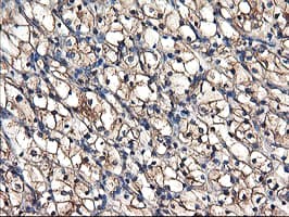 TUBAL3 Antibody (clone OTI4D8)