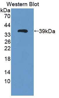 LGALS12 / Galectin 12 Antibody (aa1-314)