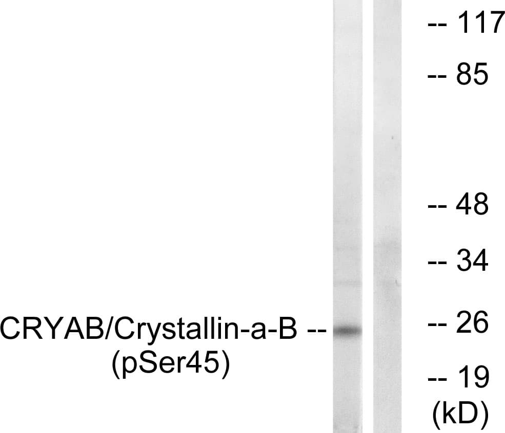 CRYAB / Alpha B Crystallin Antibody (phospho-Ser45)