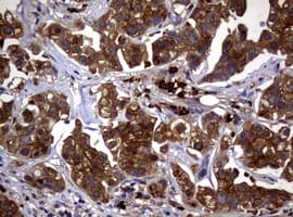 NME1 / NM23 Antibody (clone OTI6E9)