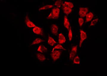 NR3C1/Glucocorticoid Receptor Antibody (phospho-Ser203)