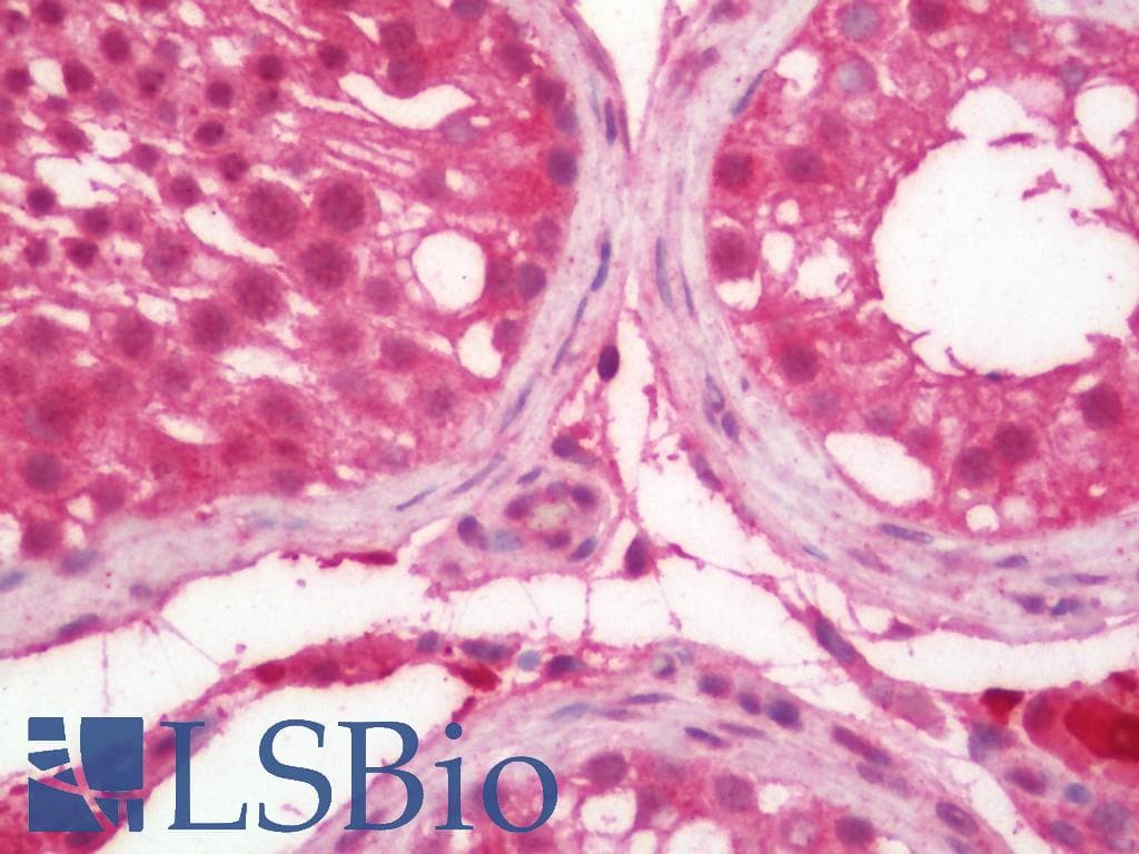 IHC-plus™ SLC29A3 / ENT3 Antibody