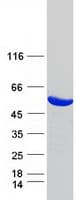 Human UMPS / OPRT Protein (Recombinant Myc-DDK (Flag))