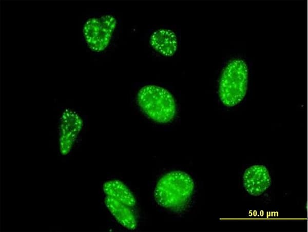 IHC-plus™ NFAT4 / NFATC3 Antibody (clone 3A12)