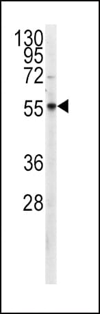 PKM / Pyruvate Kinase, Muscle Antibody (aa460-489)