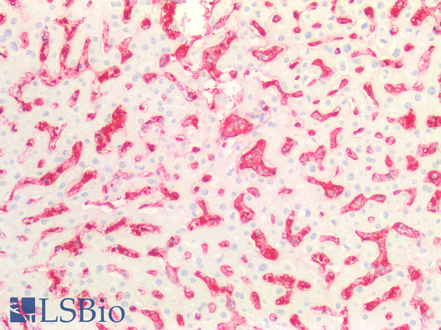IHC-plus™ Blood Group A Antibody (clone 3-3A)