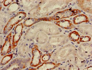 Polyclonal Rabbit anti-Human TRIM39 / RNF23 Antibody (IHC, IF, WB)