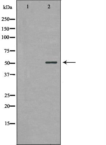 PARK2 / Parkin 2 Antibody