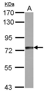 Polyclonal Rabbit anti-Human GYS1 / Glycogen Synthase Antibody (WB)