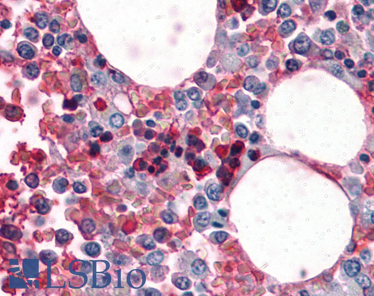 IHC-plus™ Hemoglobin Antibody (clone HB11-201.11)
